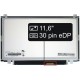 Laptop Bildschirm Toshiba Satellite CL10-B-101 LCD Display 11,6“ 30pin eDP HD LED Slim - Glänzend
