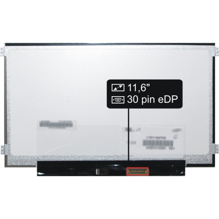 Laptop Bildschirm IBM Lenovo ThinkPad 11E 20ED000CUS LCD Display 11,6“ 30Pin HD LED Slim - Glänzend