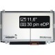 Laptop Bildschirm Toshiba Satellite CL10-B SERIES LCD Display 11,6“ 30pin HD LED Slim - Matt